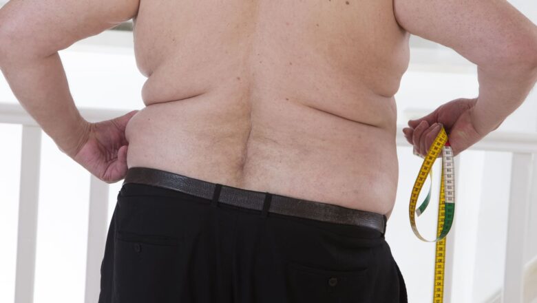 Obesity and Metabolic Syndrome